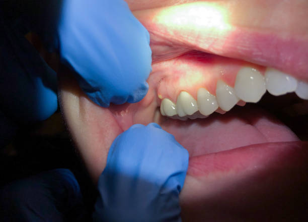 Best Urgent Dental Care for Toothaches in Old Fig Garden, CA