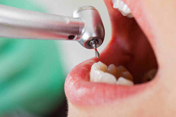  Old Fig Garden, CA Emergency Dentist Pros